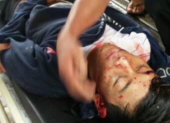 Jasad korban Ardiansyah yang dievakuasi usai mengalami kecelakaan.