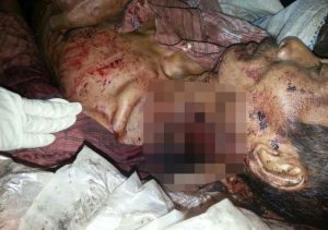 Gara-gara Persoalan Pagar Kebun Warga Muara Enim Ini Tega Membacok Tetangga Kebunnya