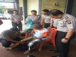 Kapolres Mura Pasangkan Kaki Palsu Pada Penyandang Disabilitas