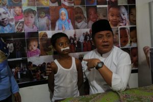 Gubernur Kunjungi Rumah Singgah Pasien Bibir Sumbing